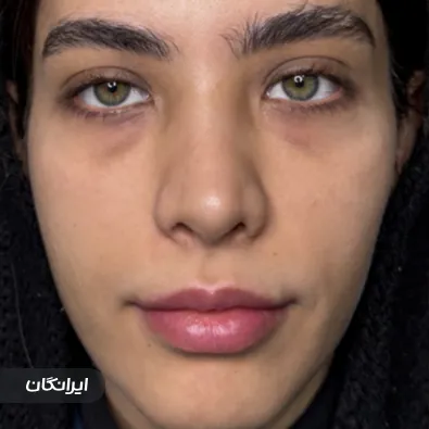 کلینیک زیبایی هانیسا