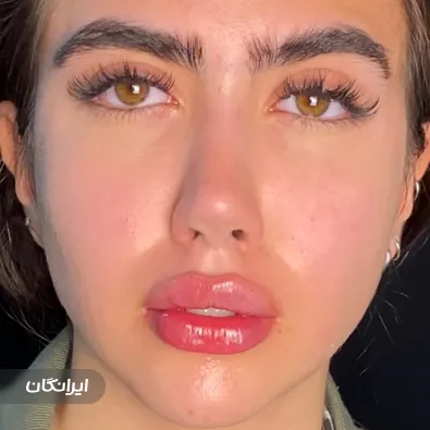 کلینیک زیبایی دکتر نیلوفر مریمی