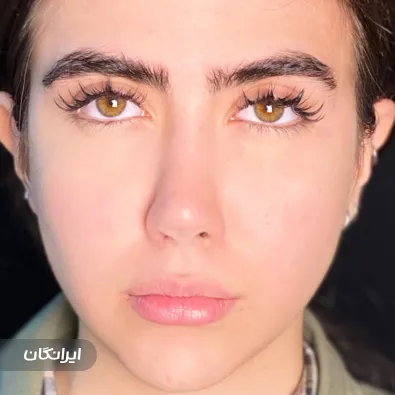 کلینیک زیبایی دکتر نیلوفر مریمی