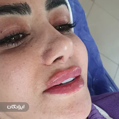 کلینیک زیبایی دکتر نینا قلی زاد