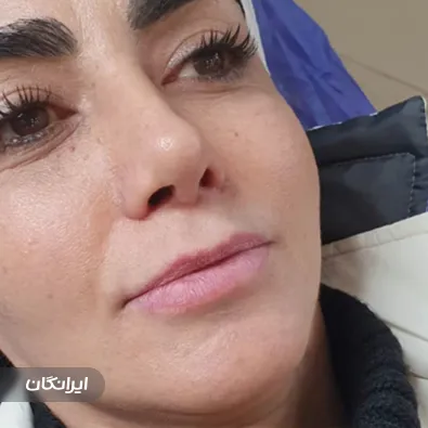 کلینیک زیبایی دکتر نینا قلی زاد