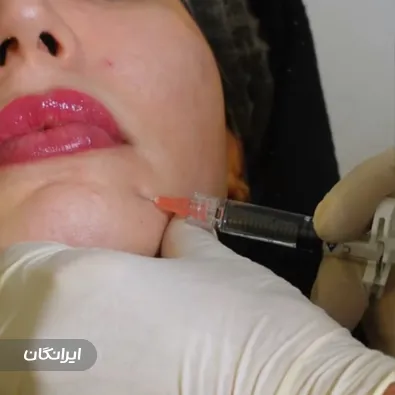 کلینیک زیبایی دلاژین