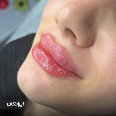 کلینیک زیبایی پرندآور