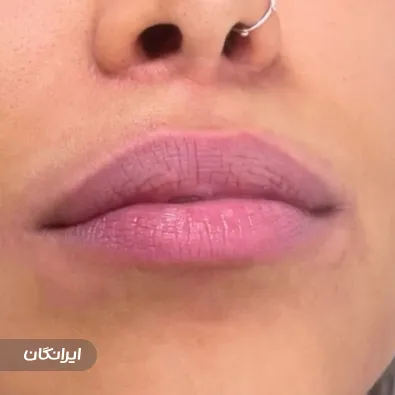 کلینیک زیبایی دکتر پرویز احقر