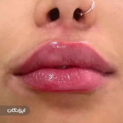 کلینیک زیبایی دکتر پرویز احقر