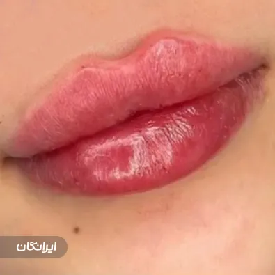 کلینیک زیبایی فرناز