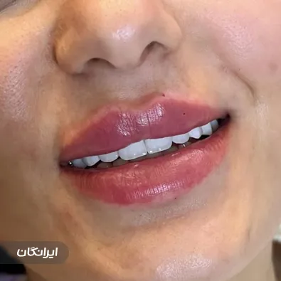 کلینیک زیبایی نصرتی