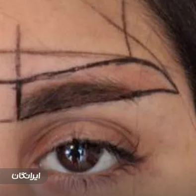 کلینیک زیبایی آفرینش