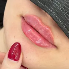 کلینیک زیبایی دکتر مهرناز سلطانی