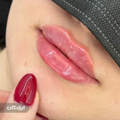 کلینیک زیبایی دکتر مهرناز سلطانی