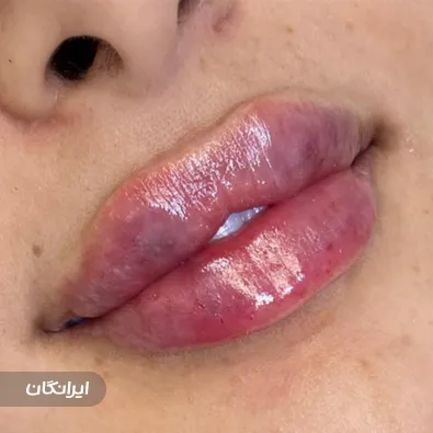 کلینیک زیبایی دکتر مهرناز سلطانی