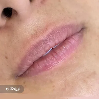 کلینیک زیبایی دکتر مهرناز سلطانی