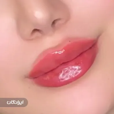 کلینیک زیبایی روی ماه