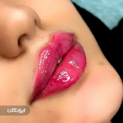 کلینیک زیبایی روی ماه