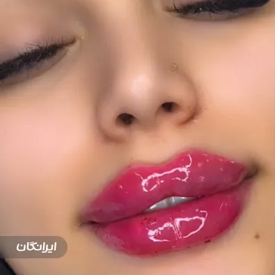 کلینیک زیبایی روی ماه