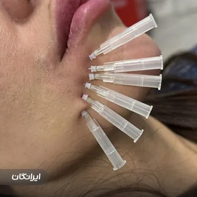 کلینیک زیبایی دکتر آذین آذربایجانی