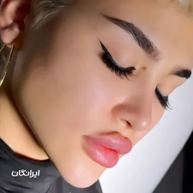 کلینیک زیبایی آذین