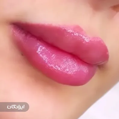 کلینیک زیبایی سون بیوتی