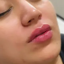 کلینیک زیبایی سون بیوتی