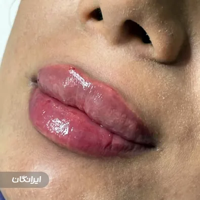 کلینیک زیبایی سون بیوتی