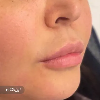 کلینیک زیبایی نازلی