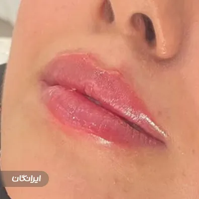 کلینیک لیزر و زیبایی لیا