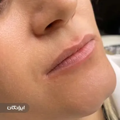 کلینیک زیبایی هلس