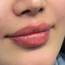 کلینیک زیبایی هلس