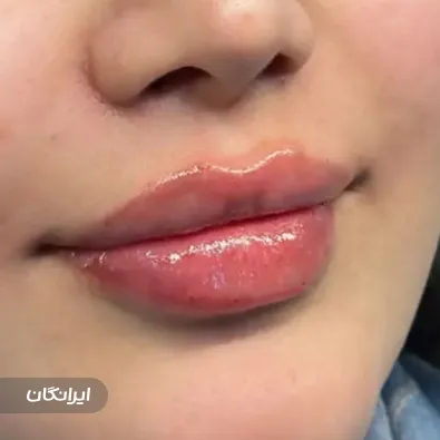 کلینیک زیبایی هلس