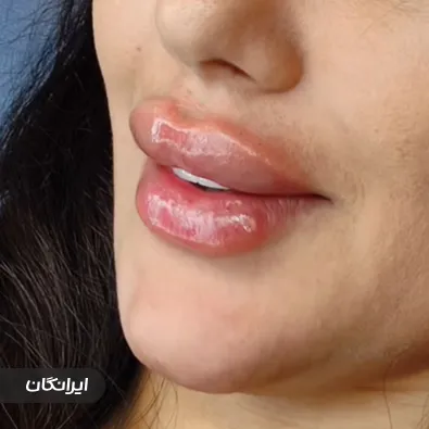 کلینیک زیبایی بهار