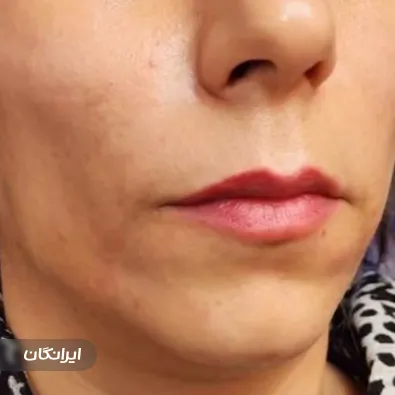 کلینیک زیبایی راما