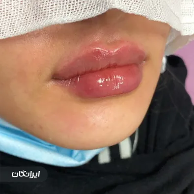 کلینیک زیبایی پارميس