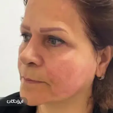 کلینیک زیبایی آویش