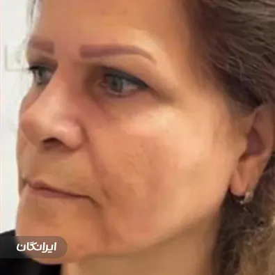 کلینیک زیبایی آویش