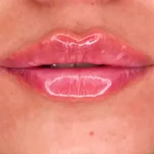 کلینیک زیبایی آویش