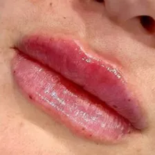 کلینیک زیبایی بهارو