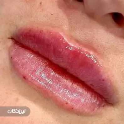 کلینیک زیبایی بهارو