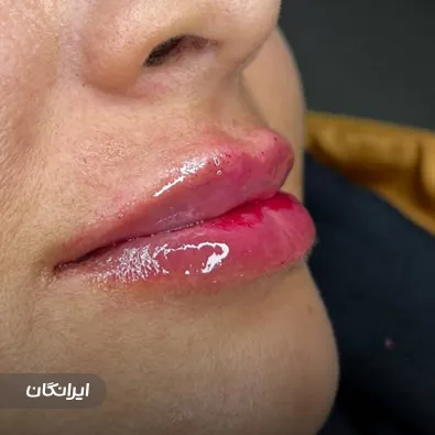 کلینیک زیبایی آیلی