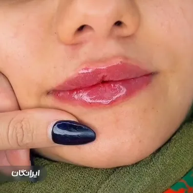 کلینیک زیبایی آیلی