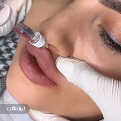 کلینیک زیبایی دکتر نگار اقبالی فرد