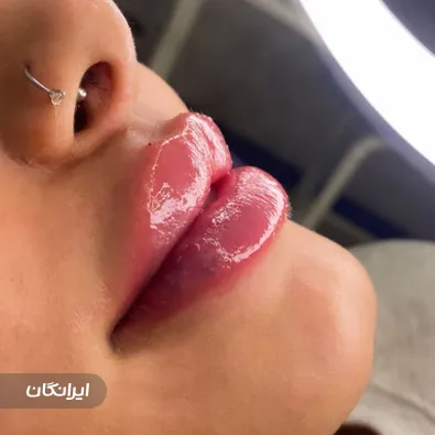 کلینیک زیبایی الماس