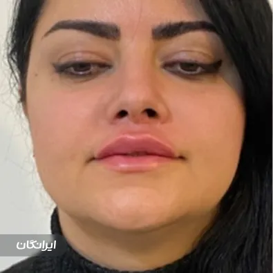 کلینیک زیبایی کیارام