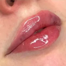 کلینیک زیبایی پلاتین