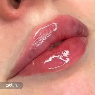 کلینیک زیبایی پلاتین