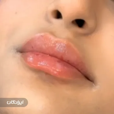 کلینیک زیبایی پلاتین