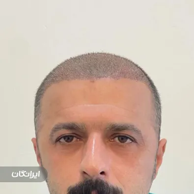 کلینیک زیبایی دکتر بابک آذین فر