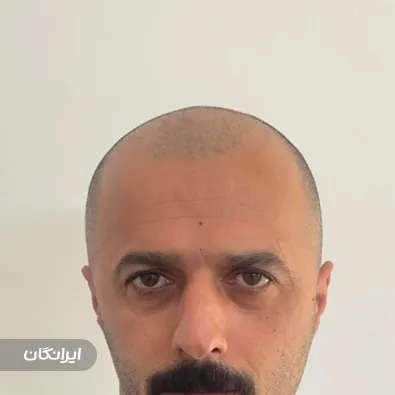 کلینیک زیبایی دکتر بابک آذین فر