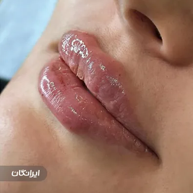 کلینیک زیبایی آرامش