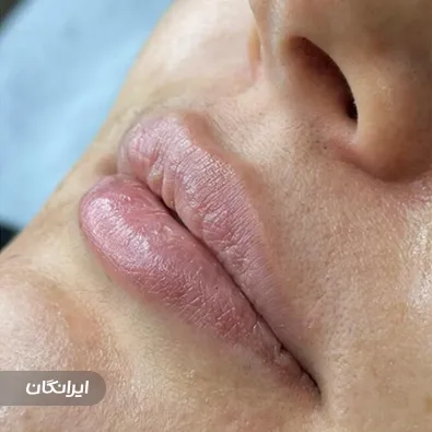 کلینیک زیبایی آرامش