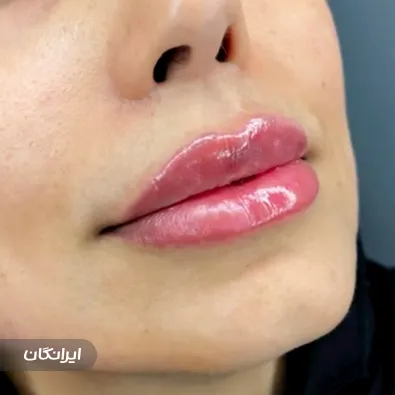 کلینیک زیبایی آرامش